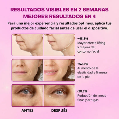 Masajeador Facial 7 en 1 con Tecnología LED por Microcorriente